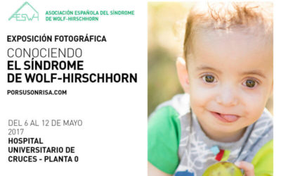 La Exposición Itinerante «Conociendo el Síndrome de Wolf-Hirschhorn» llega a Bilbao