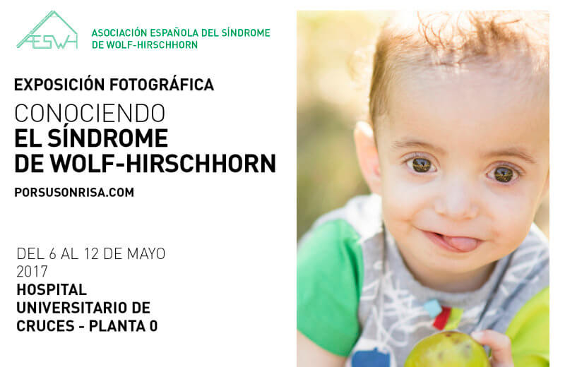 La Exposición Itinerante «Conociendo el Síndrome de Wolf-Hirschhorn» llega a Bilbao