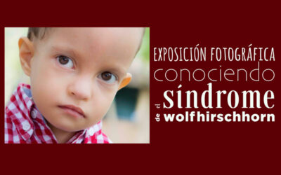 La Exposición fotográfica “Conociendo el Síndrome de Wolf-Hirschhorn” viaja a Cádiz
